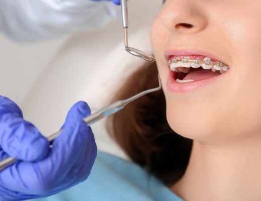 How To Care For Your Teeth During Orthodontic Treatment?
